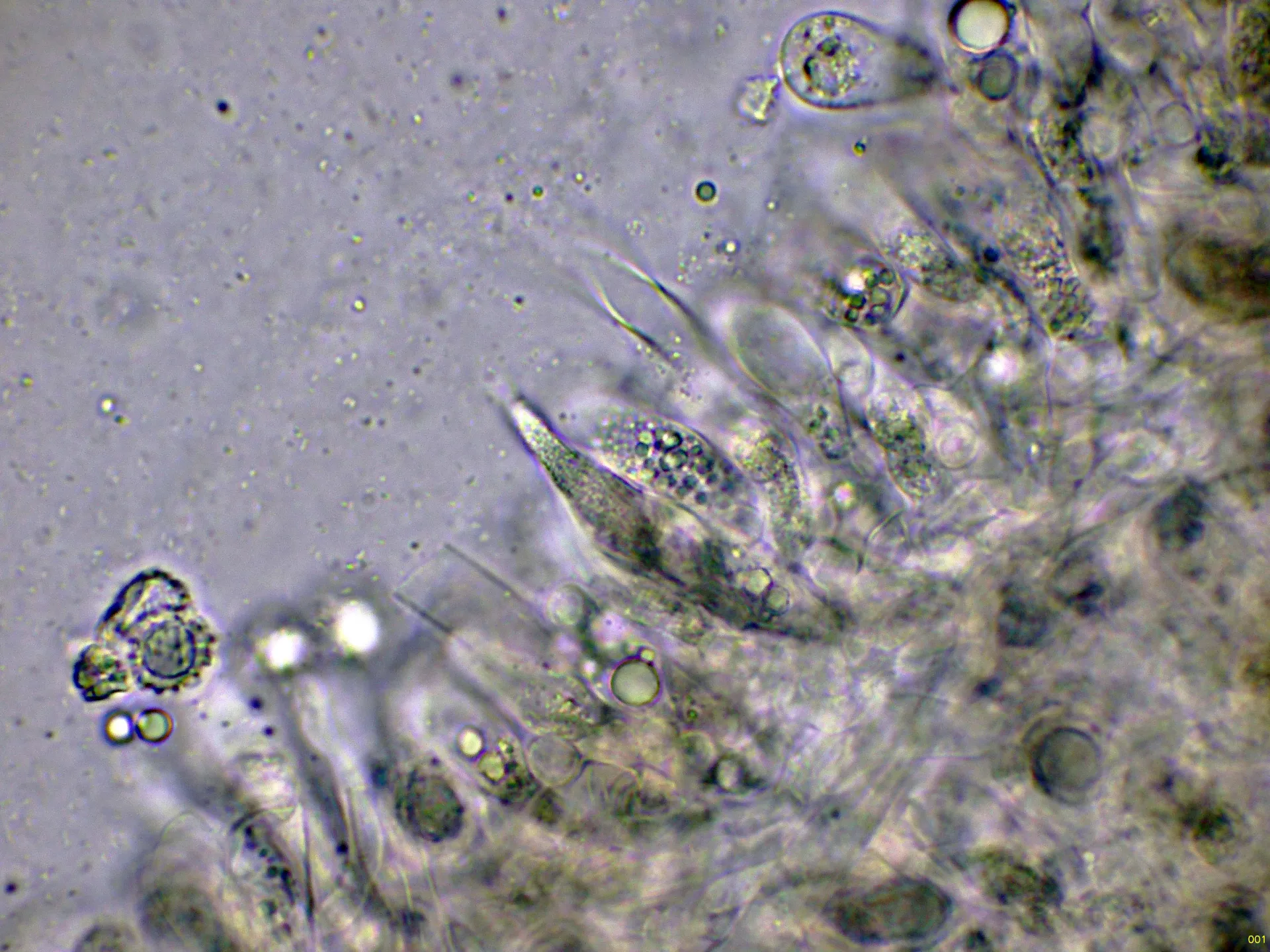 Microscopía de Lactarius torminosus - 10 - Cistidio amoníaco-001
